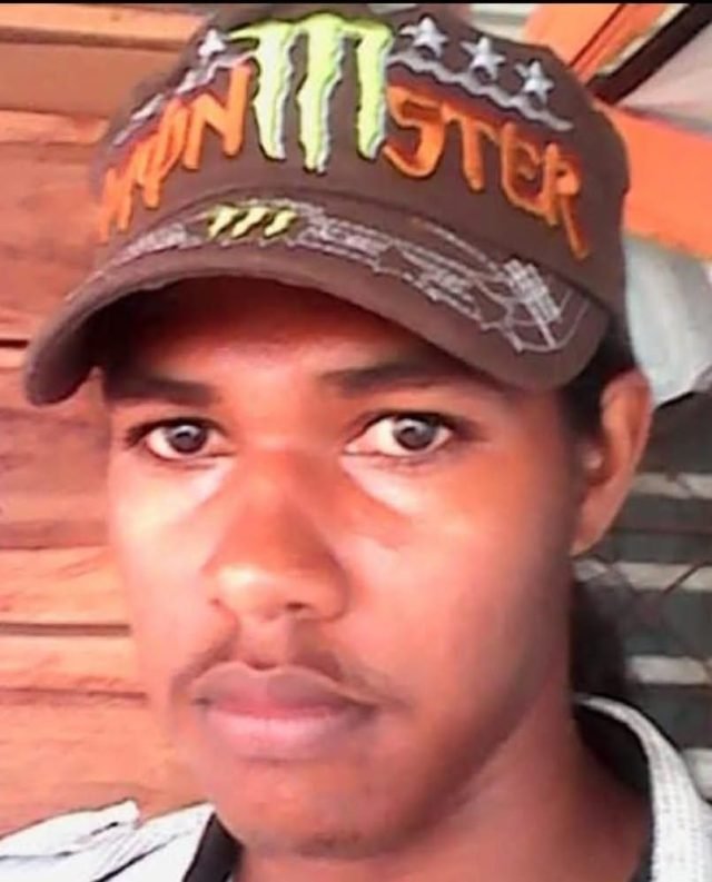 Man succumbs to burn injuries