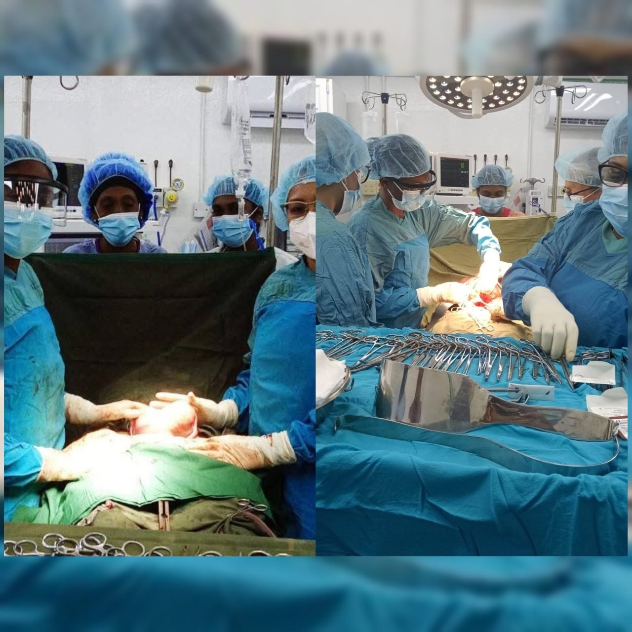 Suddie Hospital Records Over 400 Surgeries in First Half of 2025