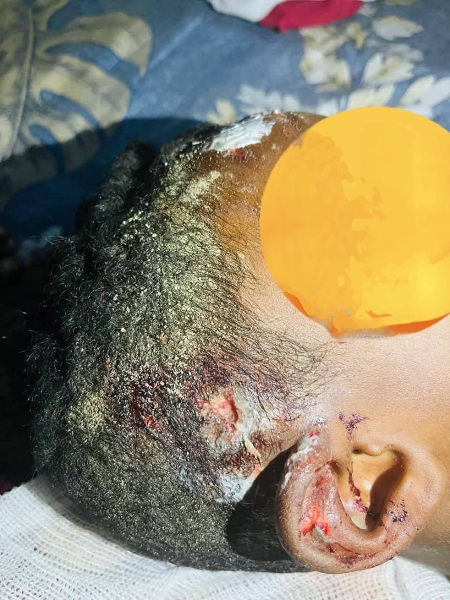 Mother seeks legal help after son injured by teacher’s vehicle